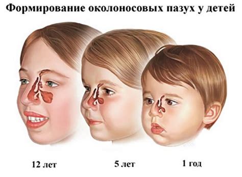 Слабое развитие лобных пазух у ребенка: