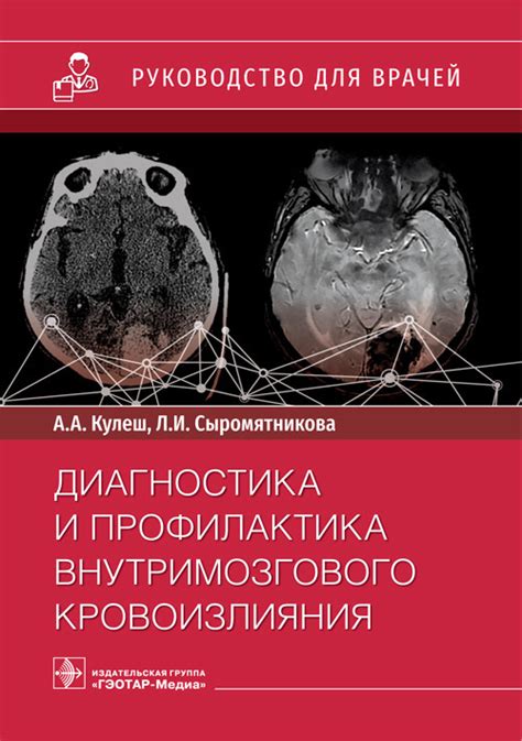 Следствия внутримозгового кровоизлияния