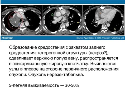 Следствия гетерогенной структуры опухоли