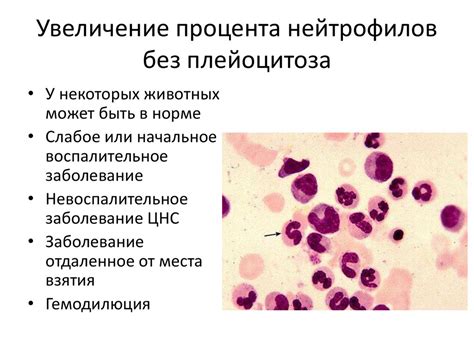 Снижение сегментоядерных нейтрофилов у ребенка