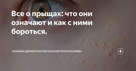 Сны о больших черных прыщах: что говорит психология?