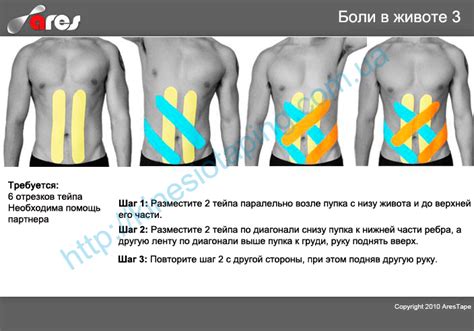 Советы по профилактике надрыва живота