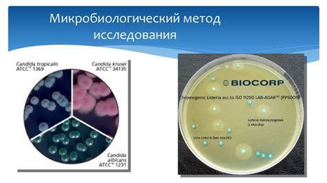 Современные методы диагностики микроделеций