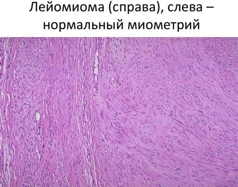 Современные методы лечения опухоли