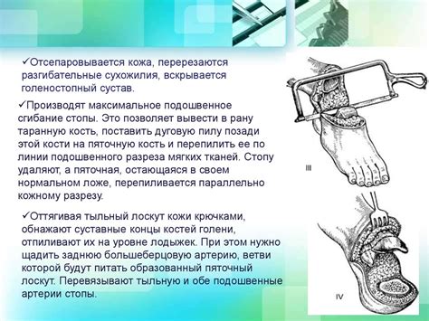 Современные методы отделения надкостницы при ампутации