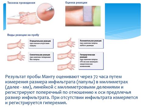 Сомнительная проба Манту: значимость и защитные меры