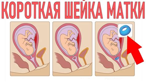 Сон о проверке на наличие беременности: как расшифровывать их смысл?