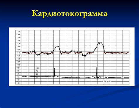 Соответствие состояния водительских навыков и беременности