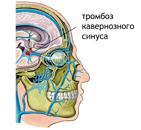 Состояние между ляшками: возможные причины и симптомы