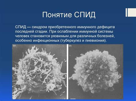 Спид Ран: понятие и значение