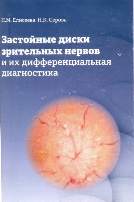 Способы диагностики застойных дисков зрительных нервов