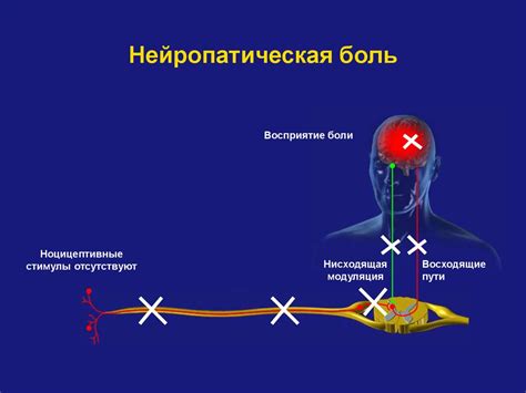 Способы лечения нейропатических болей у взрослых