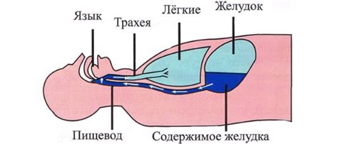 Способы лечения снижения желудочного секрета