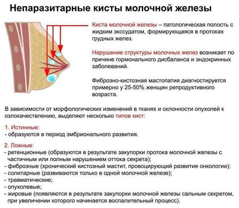 Способы облегчения