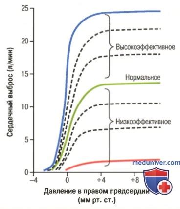 Способы оптимизации сердечного выброса для здоровья