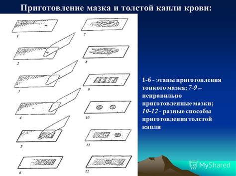 Способы поддержания мазка нормоценоза