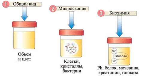 Способы устранения повышенной диастазы мочи