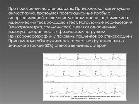 Срочность медицинской помощи при подозрении на нестабильную стенокардию