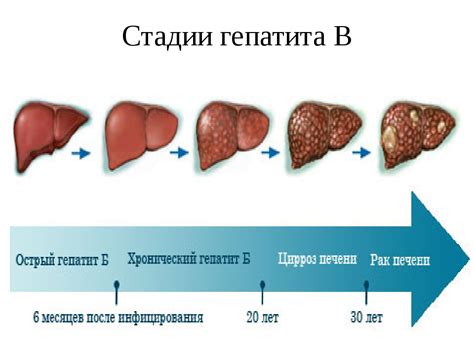 Стадии гепатита B и их проявления