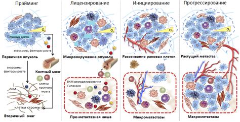 Стадии развития метастазов