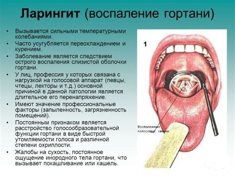 Стенозирующий ларинготрахеит: симптомы, причины и диагностика