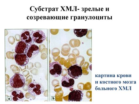 Стресс: подавляющий эффект на зрелые гранулоциты