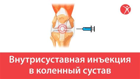 Струйная инъекция: понятие и основные принципы