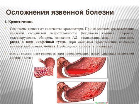 Субоптимальное наполнение желудка: смысл, причины и последствия