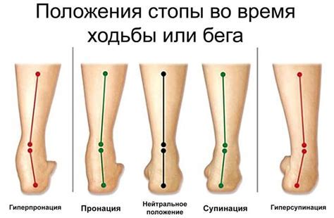 Супинация стопы: сущность и влияние на организм