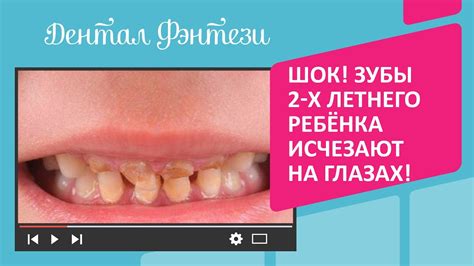 Тайна сновидения: разгадка, когда зубы исчезают бесследно и безболезненно