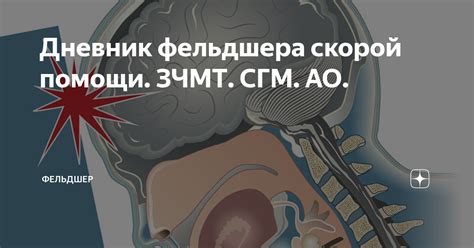 Тайны успешного применения зчмт сгм