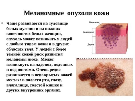 Тема 1: Появление образов о нижних конечностях с дефектами кожи.