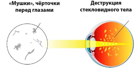 Темные точки перед глазами