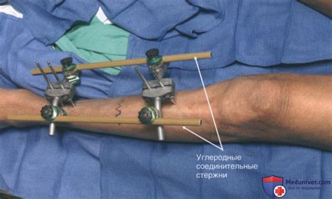 Техника избегания получения повреждений