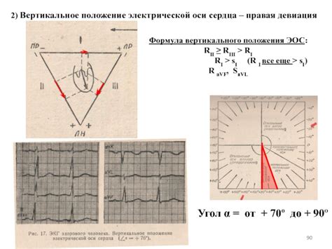 Техники проверки вертикального положения эос