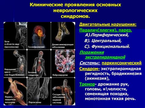 Типичные проявления неврологических болей