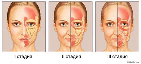 Типичные симптомы при синюшном оттенке лица