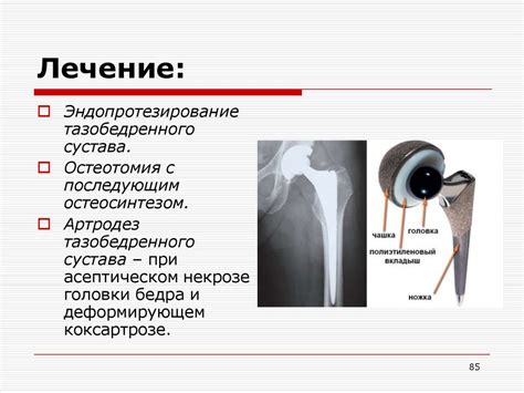 Травмы и повреждения бедра