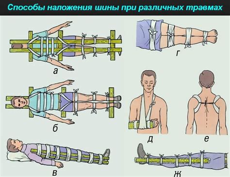 Травмы и телесные неприятности