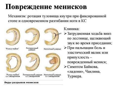 Травмы коленного сустава