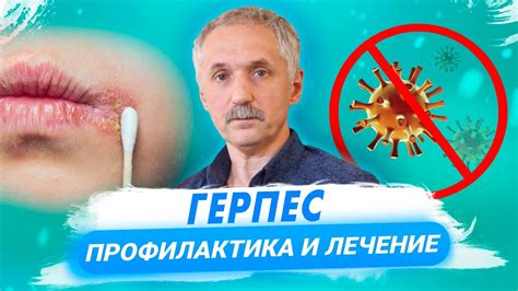 Традиционные методы лечения герпеса