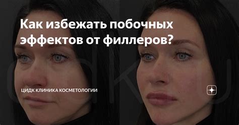 Трансдермальное применение: позволяет ли избежать побочных эффектов?