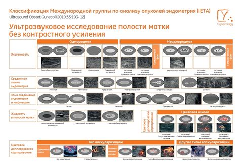 Трехслойная структура эндометрия: подробное описание каждого слоя