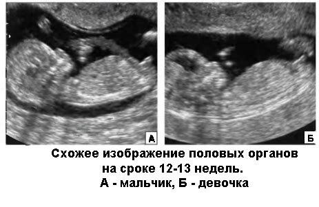 УЗИ и определение возраста беременности