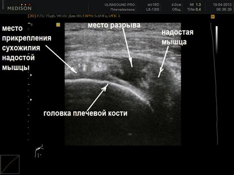 УЗИ мелких суставов: суть и назначение