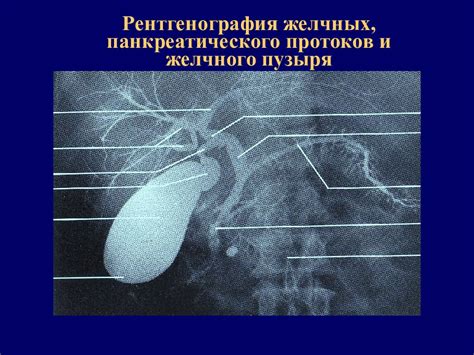 УЗИ холедоха: особенности и возможности