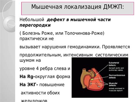 УЗ признаки ДМЖП: описание, причины и лечение