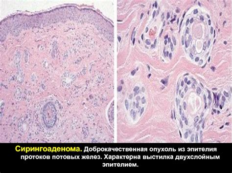 Увеличенная активность потовых желез