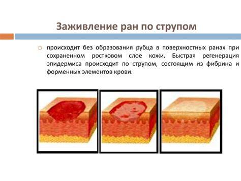 Увлажнение и заживление ран