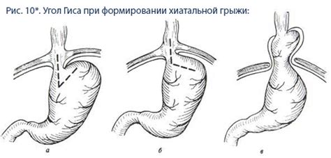 Угол ГИСа: основные принципы и функции